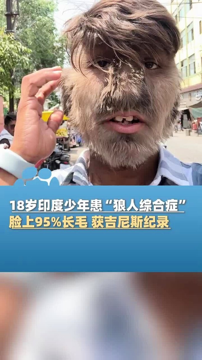 18禁视频入口的相关介绍